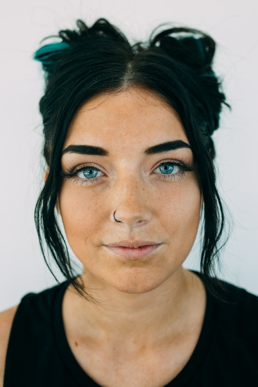 After — six months post-op